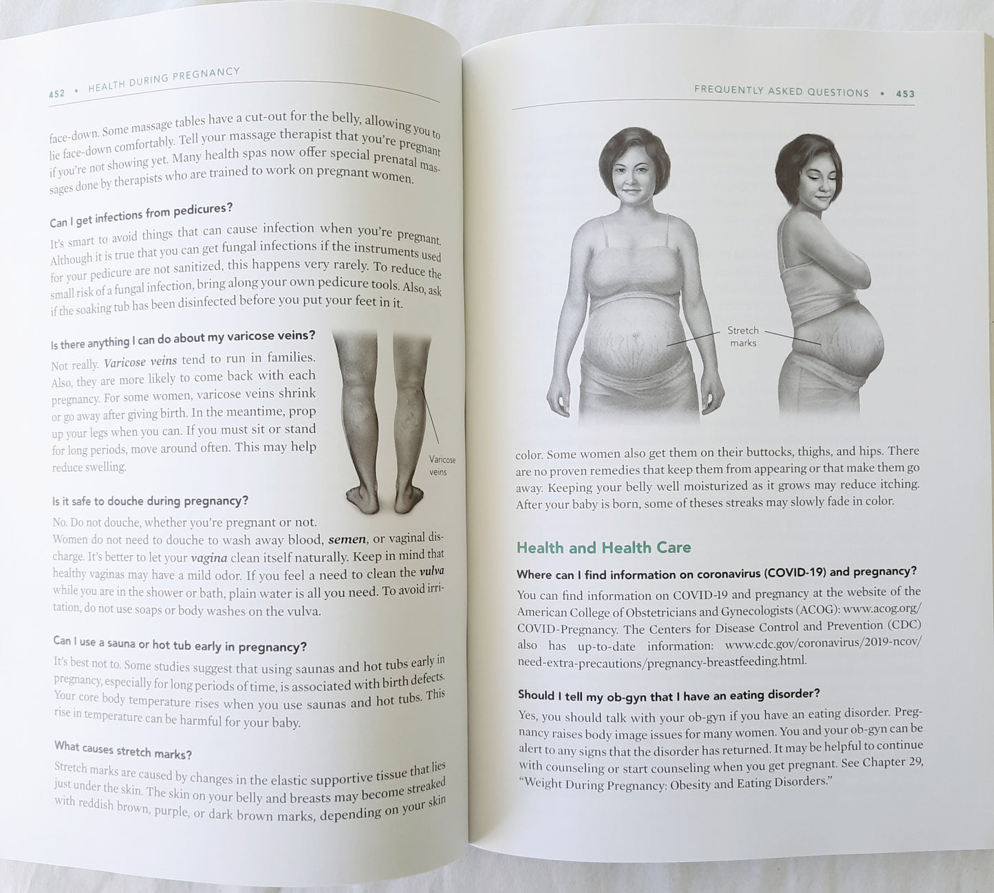 Your Pregnancy and Childbirth Month to Month 7th edition by ACOG (Like New, 2021, Pbk, 762 pages, American College of Obstetricians and Gynecologists)