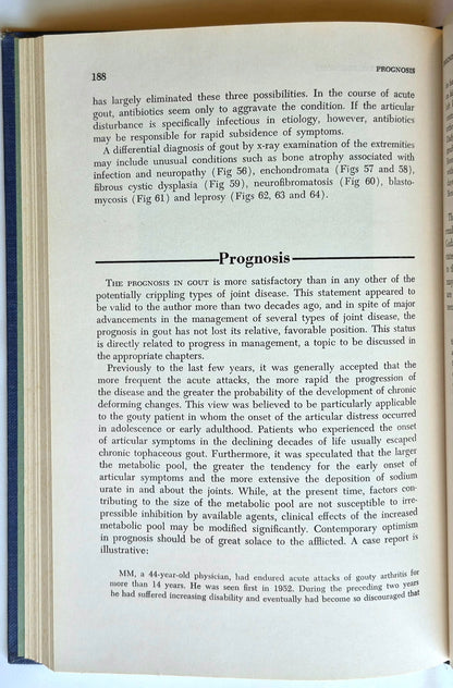 Gicht Zweite Auflage von John H. Talbott M.D. (Gut, 1964, gebunden, 261 Seiten, Grune & Stratton)