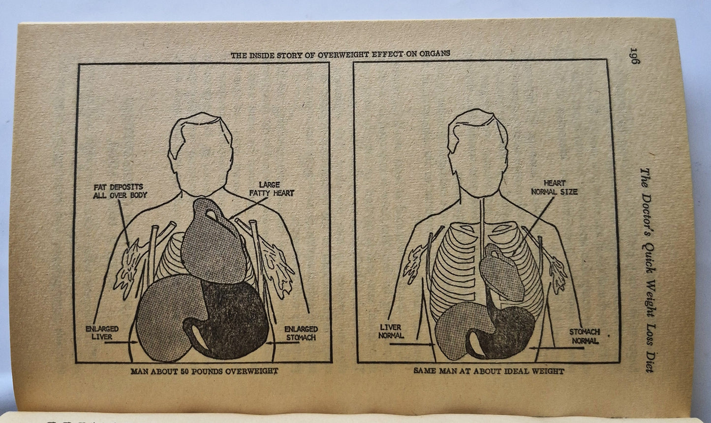 The Doctor's Quick Weight Loss Diet von Irwin M. Stillman; Samm S. Baker (Sehr gut, 1983, Taschenbuch, 252 Seiten, Dell)