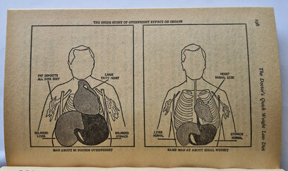The Doctor's Quick Weight Loss Diet von Irwin M. Stillman; Samm S. Baker (Sehr gut, 1983, Taschenbuch, 252 Seiten, Dell)