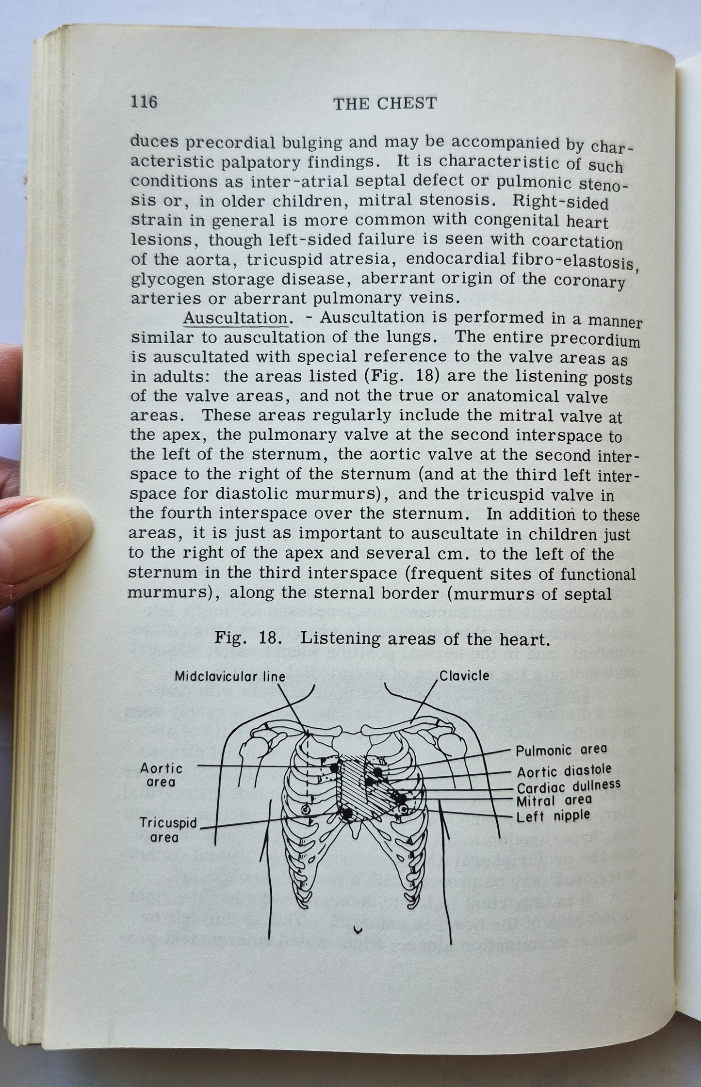 Manual of Pediatric Physical Diagnosis 4th Edition by Lewis A. Barness (Gut, 1973, Pbk, 247 S., Year Book Medical Pub.)