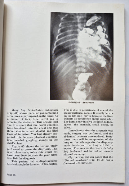 Exercises in Diagnostic Radiology 5: Pediatrics von Richard M. Heller; Lucy F. Squire (Sehr gut, 973, Pbk,
