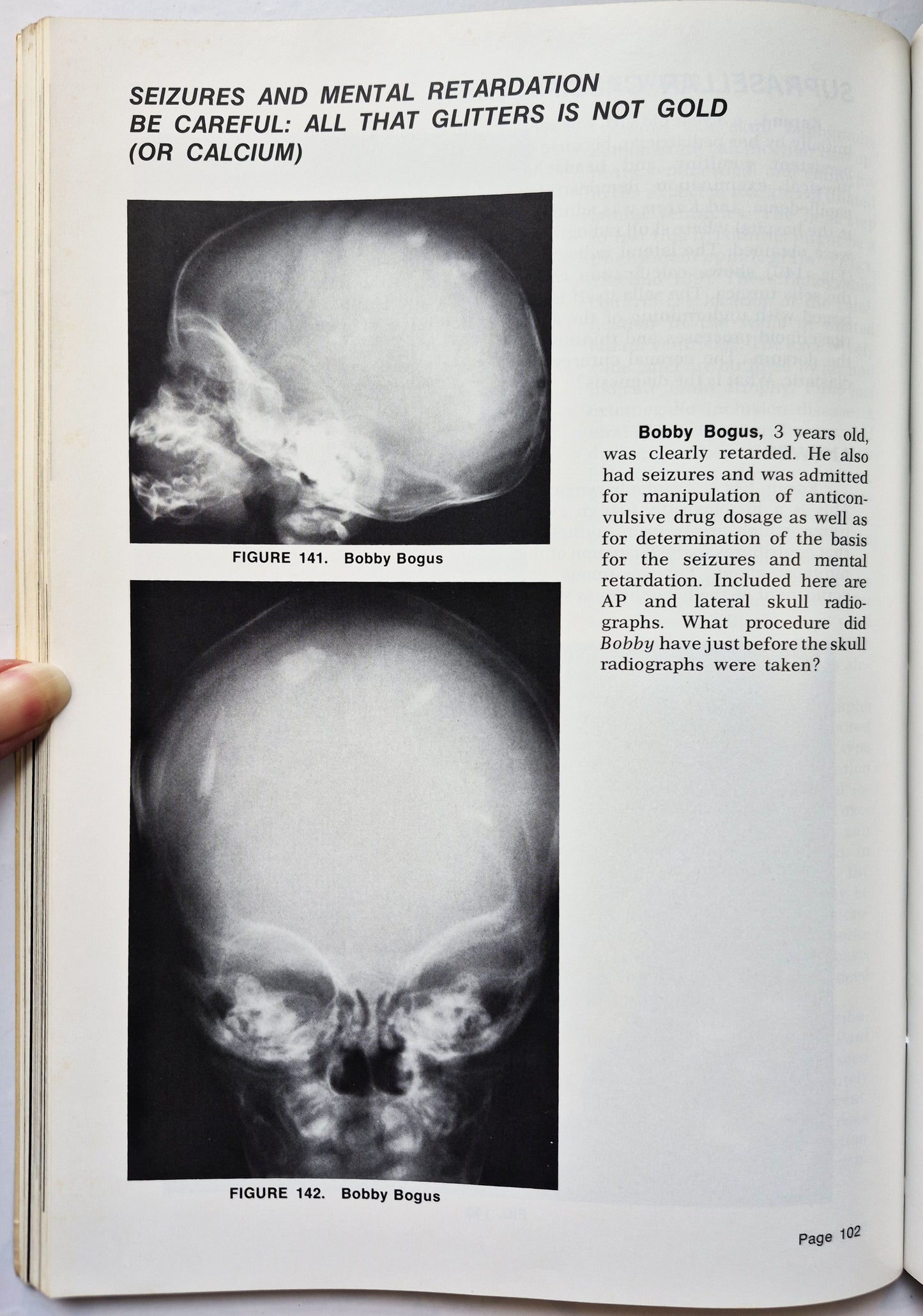 Exercises in Diagnostic Radiology 5: Pediatrics von Richard M. Heller; Lucy F. Squire (Sehr gut, 973, Pbk,