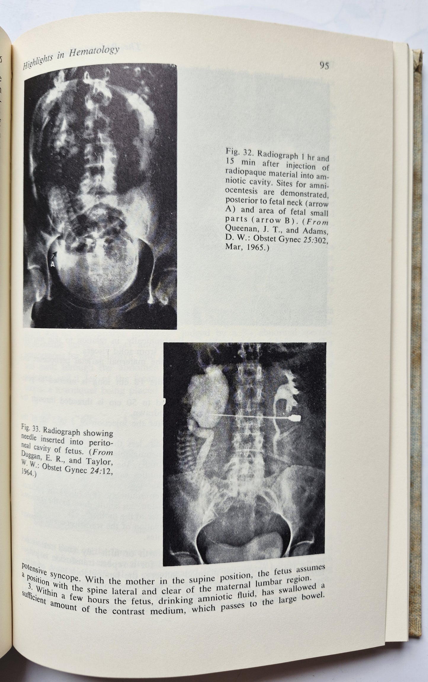 The Pediatric Patient edited by Sarah R. Gustafson; David B. Coursin (Very good, 1966, HC, 269 pgs, J. B. Lippincott Co.)