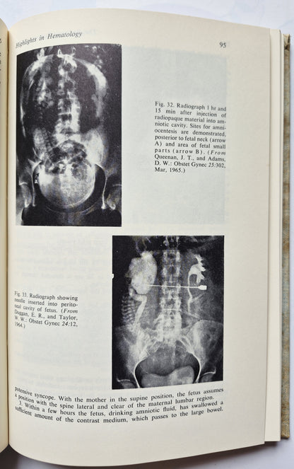 The Pediatric Patient edited by Sarah R. Gustafson; David B. Coursin (Very good, 1966, HC, 269 pgs, J. B. Lippincott Co.)