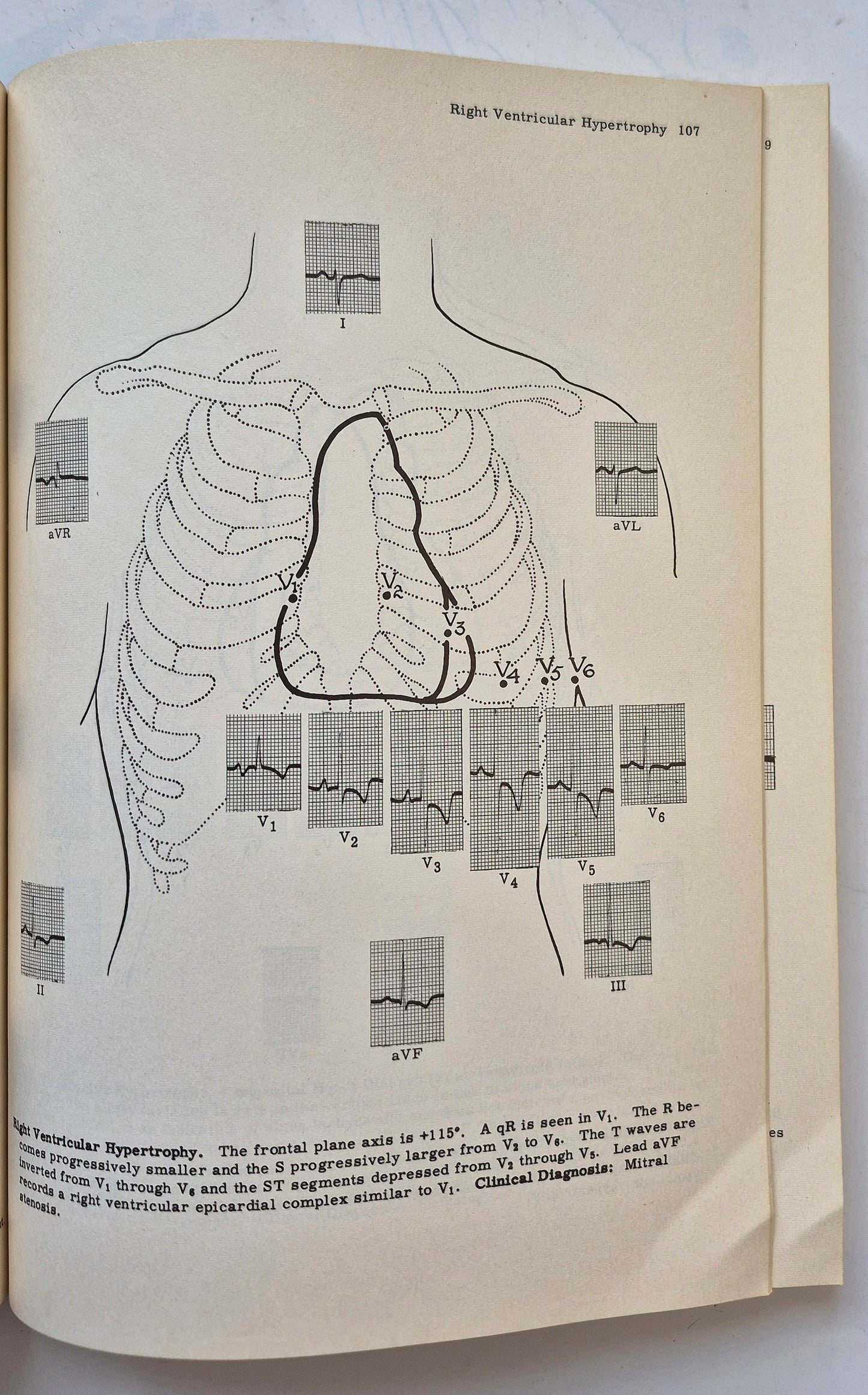 Principles of Clinical Electrocardiography by Mervin J. Goldman (Good, 1964, Pbk, 380 pgs, Lange Medical Pub.)