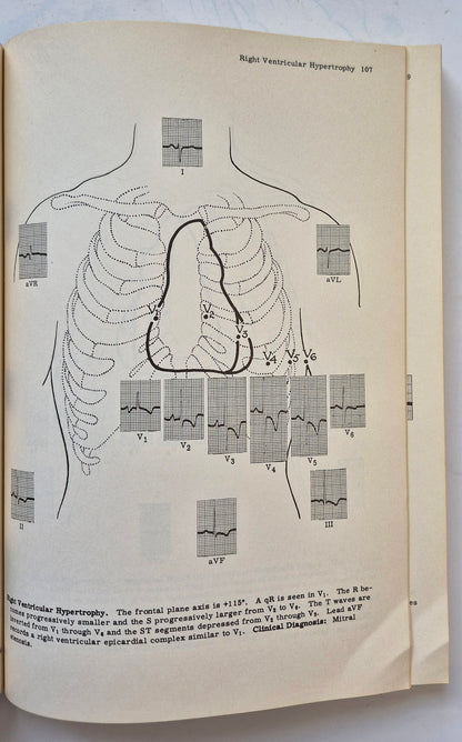 Principles of Clinical Electrocardiography by Mervin J. Goldman (Good, 1964, Pbk, 380 pgs, Lange Medical Pub.)