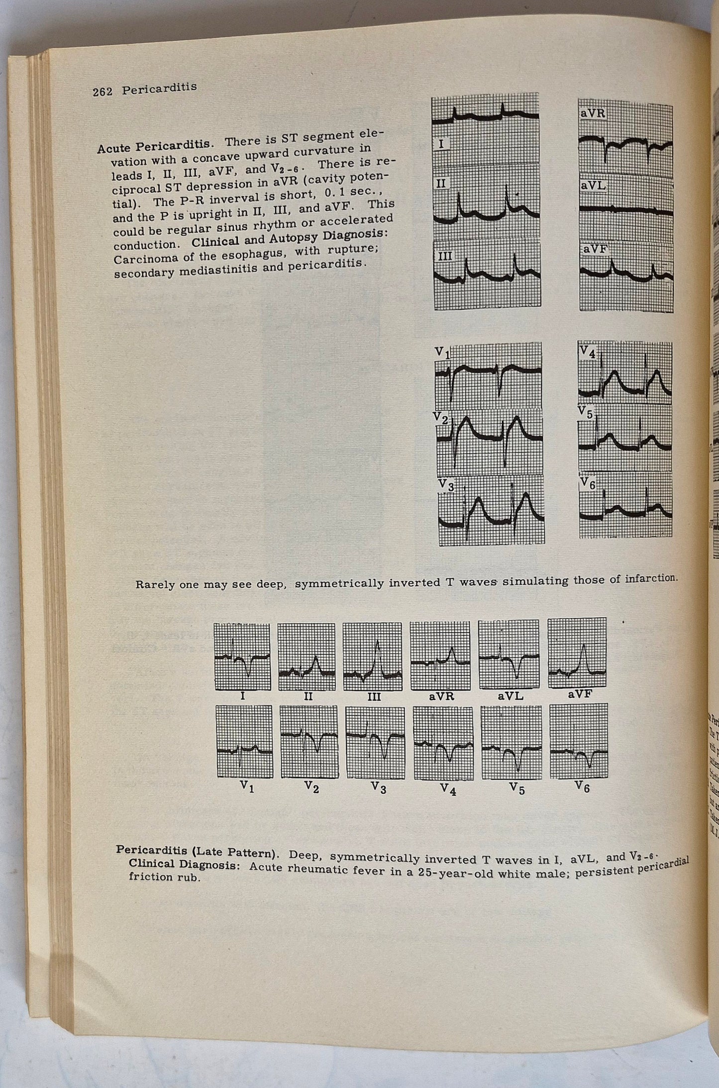 Principles of Clinical Electrocardiography by Mervin J. Goldman (Good, 1964, Pbk, 380 pgs, Lange Medical Pub.)