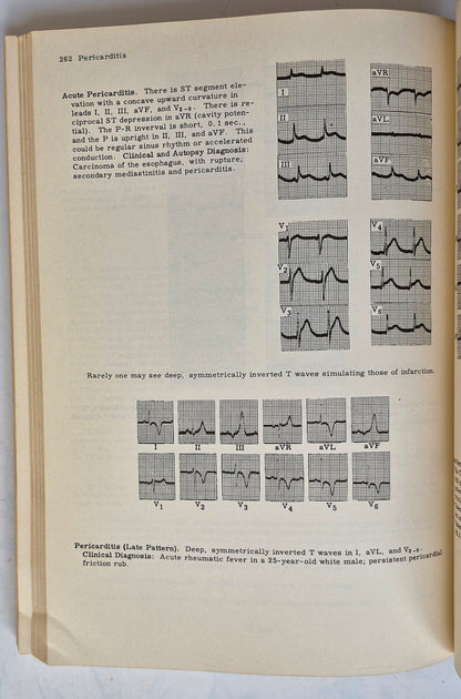 Principles of Clinical Electrocardiography by Mervin J. Goldman (Good, 1964, Pbk, 380 pgs, Lange Medical Pub.)