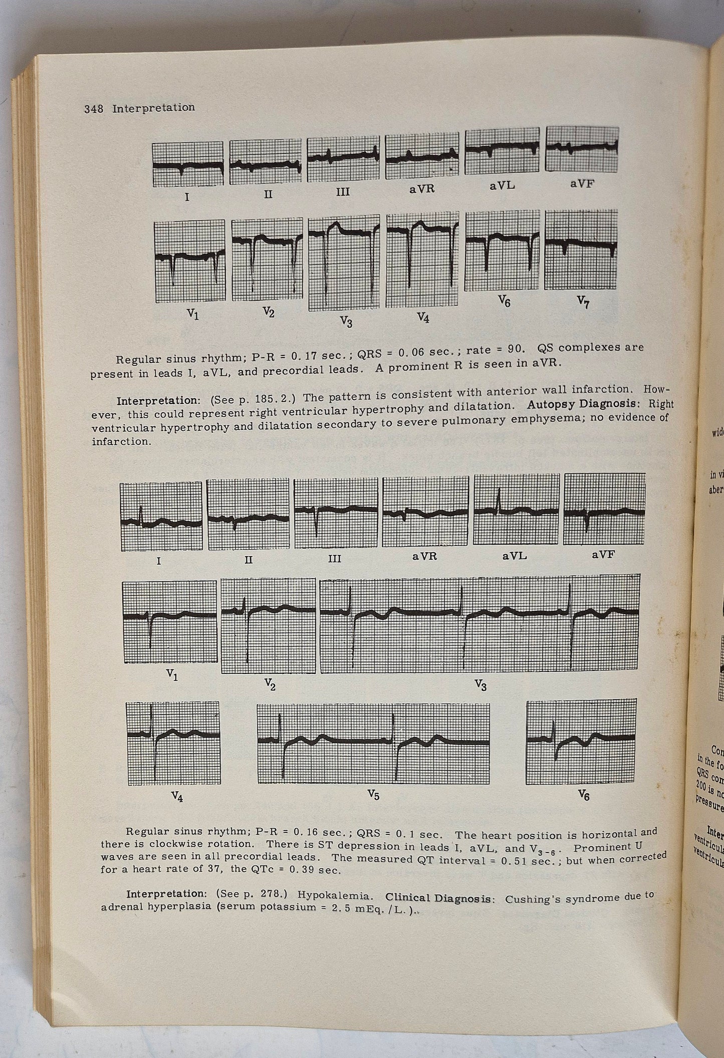 Principles of Clinical Electrocardiography by Mervin J. Goldman (Good, 1964, Pbk, 380 pgs, Lange Medical Pub.)