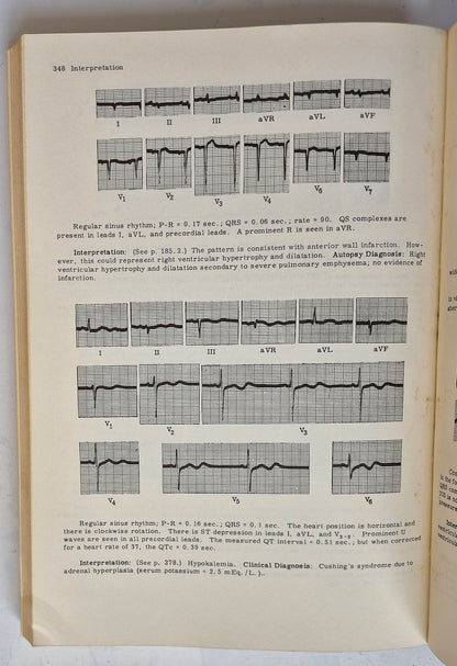 Principles of Clinical Electrocardiography by Mervin J. Goldman (Good, 1964, Pbk, 380 pgs, Lange Medical Pub.)
