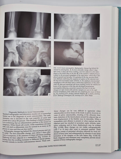 Atlas of Pediatric Physical Diagnosis 2nd edition edited by Basil J. Zitelli; Holly W. Davis (Very good, 1992, HC, Gower Medical Pub.)