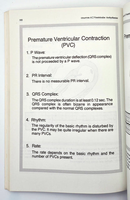 Interpretation of Arrhythmias: A Self-Study Program by Emanuel Stein (Very good, 1988, Pbk, 160 pgs, Lea & Febiger)