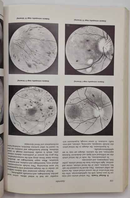 General Ophthalmology 8th Edition by Daniel Vaughan; Taylor Asbury (Very good, 1977, Pbk, 378 pgs, Lange Medical Pub.)