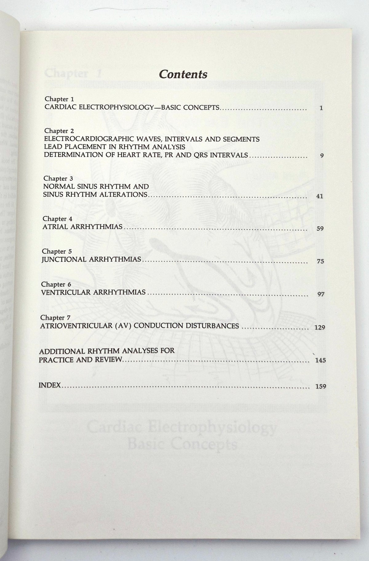 Interpretation of Arrhythmias: A Self-Study Program by Emanuel Stein (Very good, 1988, Pbk, 160 pgs, Lea & Febiger)