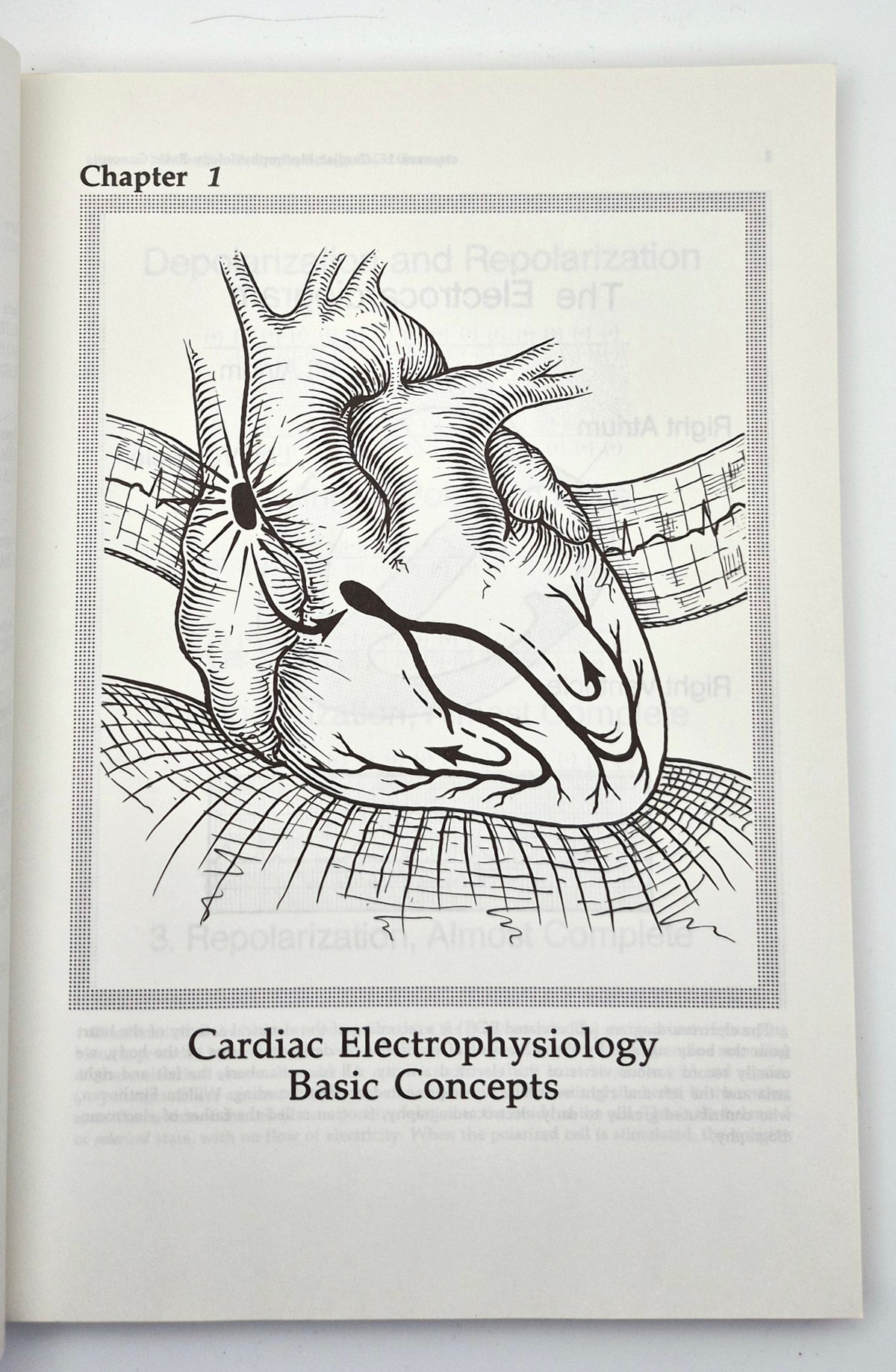 Interpretation of Arrhythmias: A Self-Study Program by Emanuel Stein (Very good, 1988, Pbk, 160 pgs, Lea & Febiger)