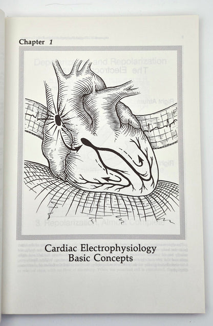 Interpretation of Arrhythmias: A Self-Study Program by Emanuel Stein (Very good, 1988, Pbk, 160 pgs, Lea & Febiger)