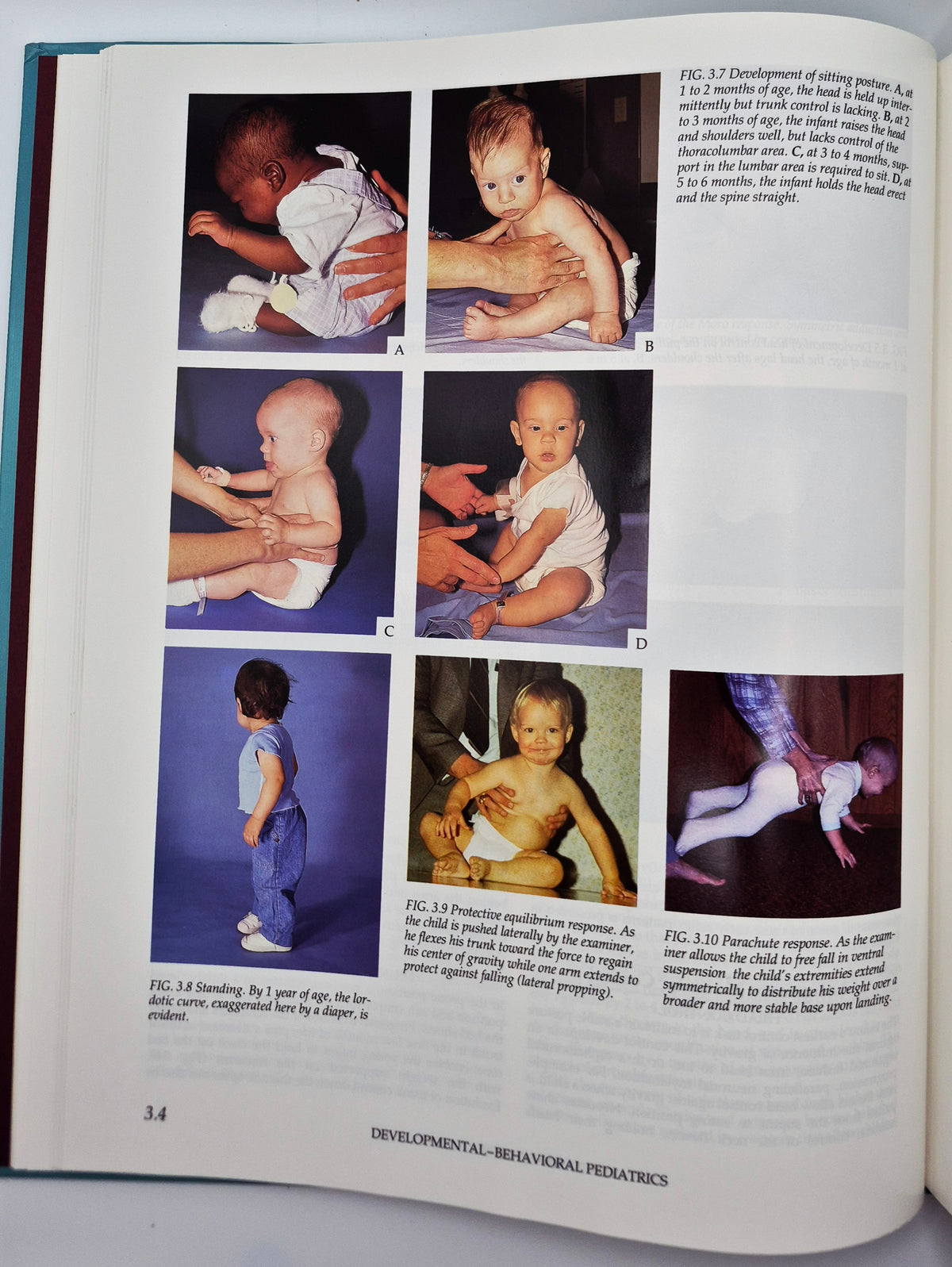 Atlas of Pediatric Physical Diagnosis 2nd edition edited by Basil J. Zitelli; Holly W. Davis (Very good, 1992, HC, Gower Medical Pub.)