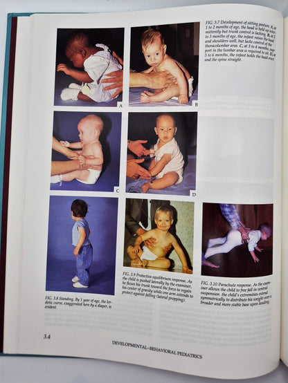 Atlas of Pediatric Physical Diagnosis 2nd edition edited by Basil J. Zitelli; Holly W. Davis (Very good, 1992, HC, Gower Medical Pub.)