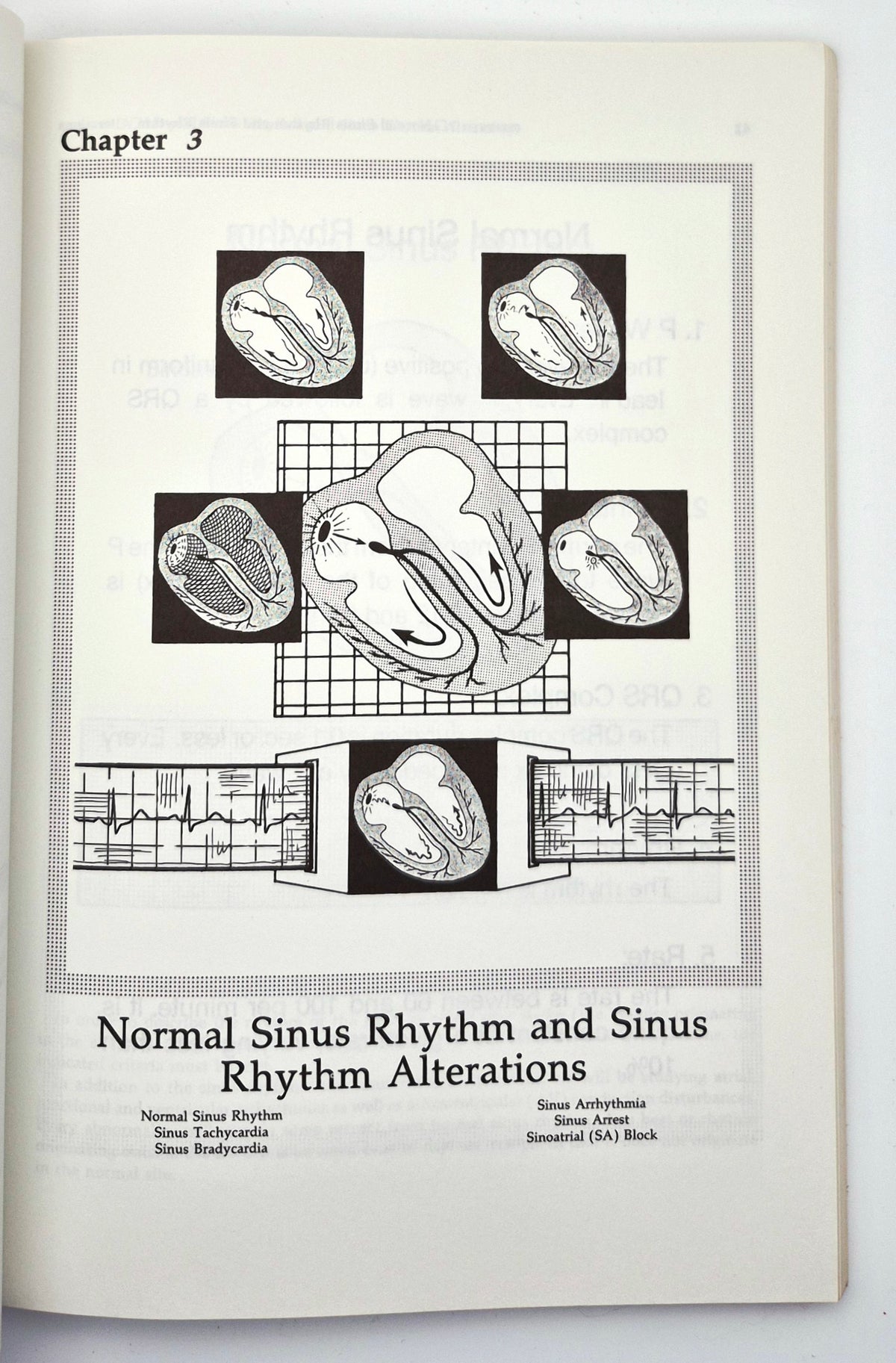Interpretation of Arrhythmias: A Self-Study Program by Emanuel Stein (Very good, 1988, Pbk, 160 pgs, Lea & Febiger)